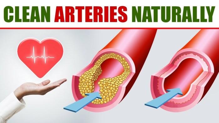 Foods to Protect Your Arteries